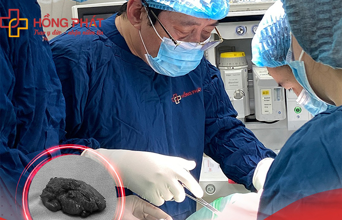 TTƯT. BSCKII. Trần Văn Bông thực hiện kỹ thuật mổ mở cải tiến cứu chữa hàng trăm bệnh nhân mắc bệnh lý về tuyến giáp