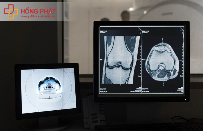 Phương pháp đo hấp thụ tia X năng lượng kép để kiểm tra mức độ loãng xương