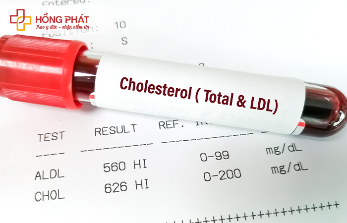 Nguyên nhân dẫn đến cholesterol tăng cao