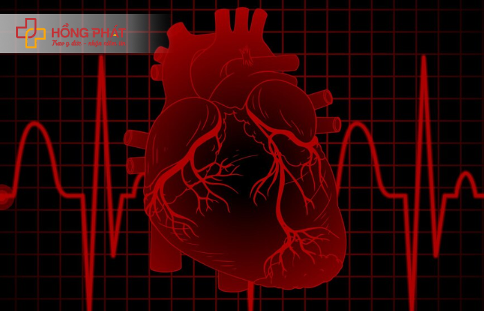 Vai trò của chẩn đoán sớm trong điều trị nhồi máu cơ tim