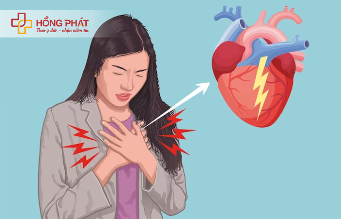 Những biến chứng nghiêm trọng của bệnh nhồi máu cơ tim