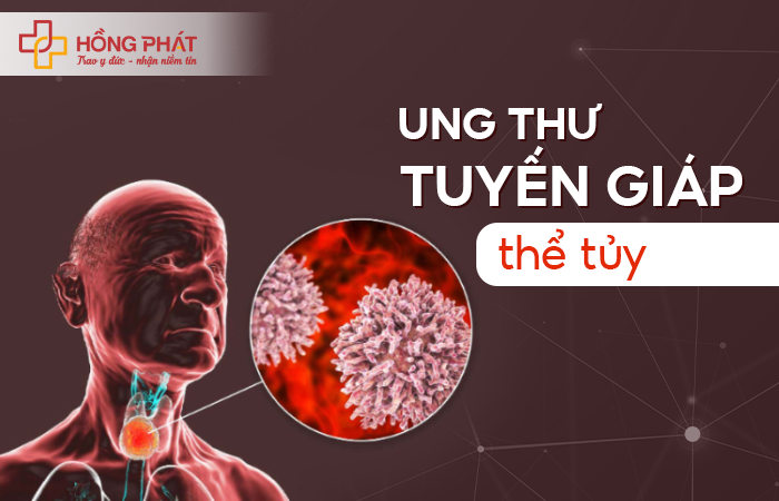 Ung thư tuyến giáp thể tủy có đáng sợ không?